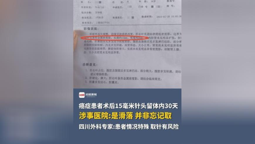 刘伯温四肖八码精选资料,烟纸盒上写建议的大爷再次爆火,广泛的解释落实方法分析_云端版V13.49